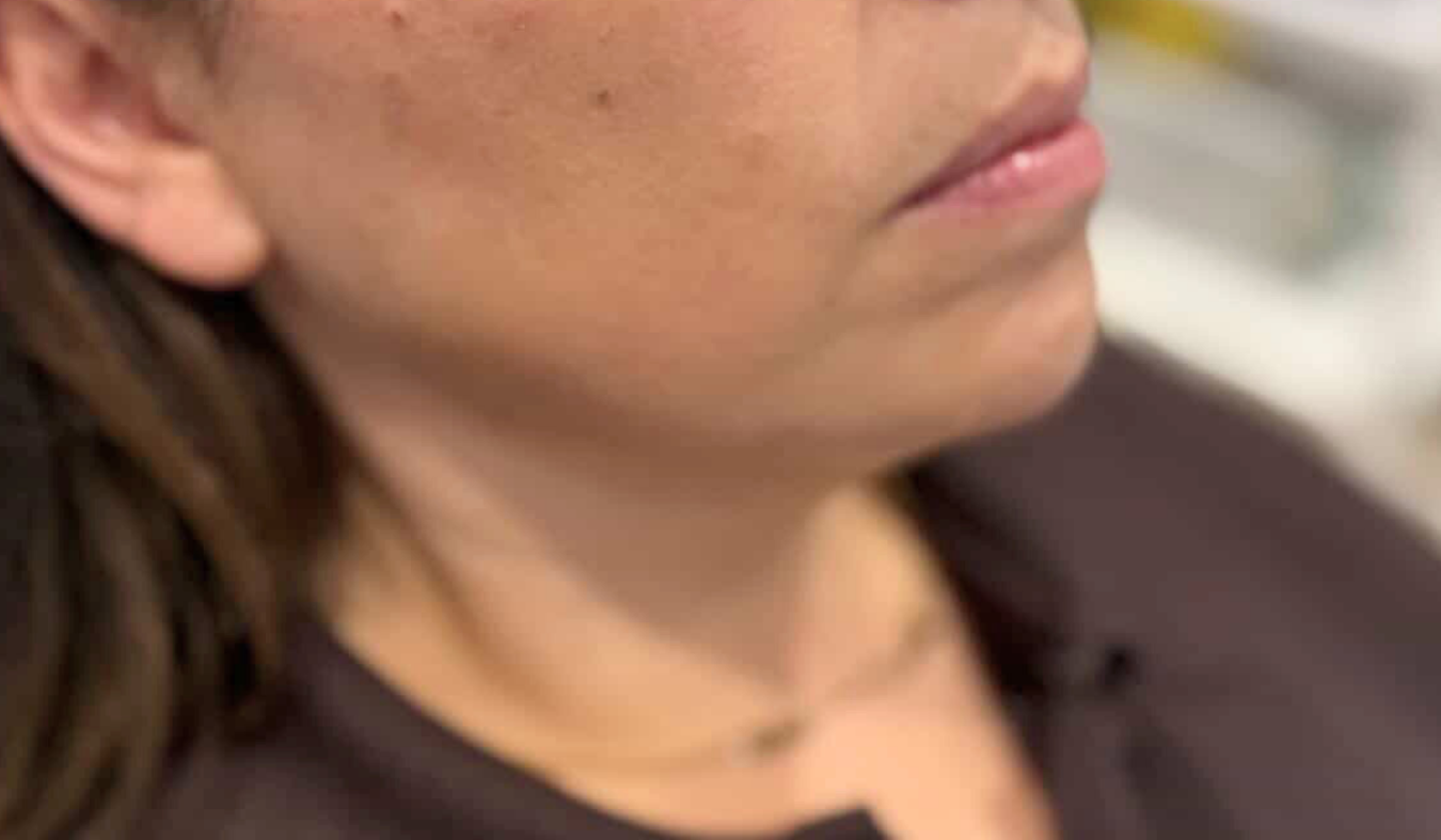 Close-up of a person's neck and shoulders with a blurred background