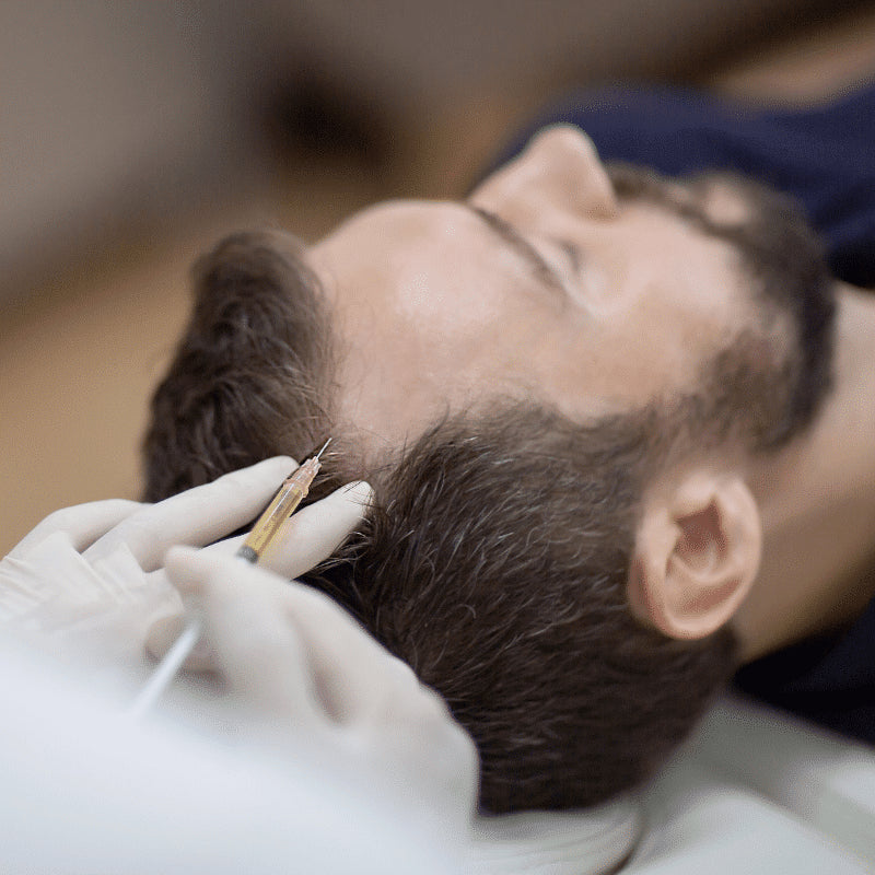 A close-up lifestyle shot of a man receiving a hair restoration or beard enhancement injection by a professional gloved hand.