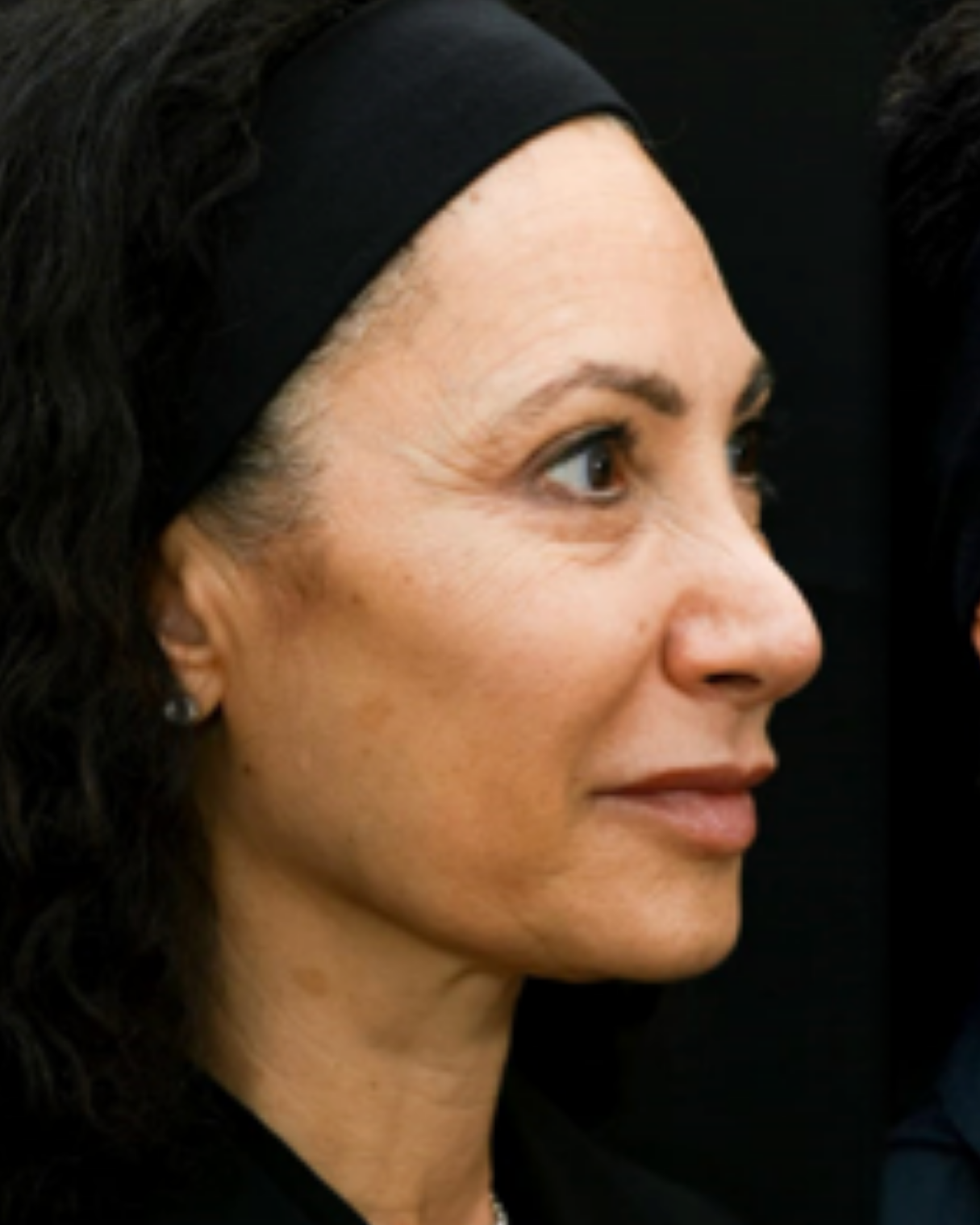 Image of a woman's face , side view, showing visible wrinkles.