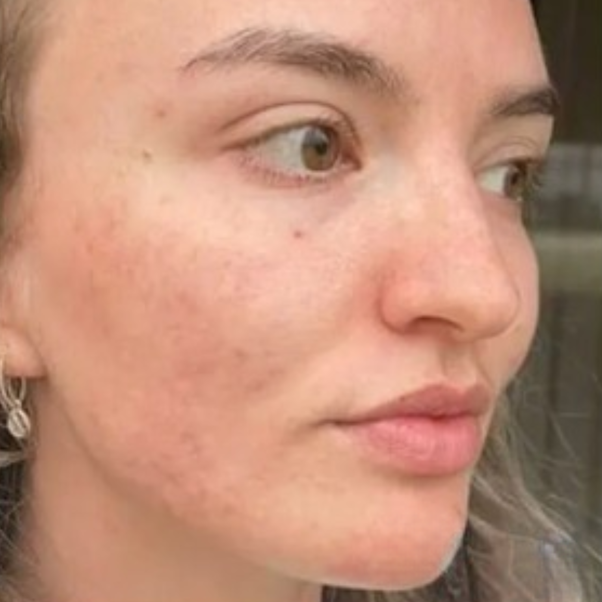 Close-up of a person's face with visible skin texture and freckles.